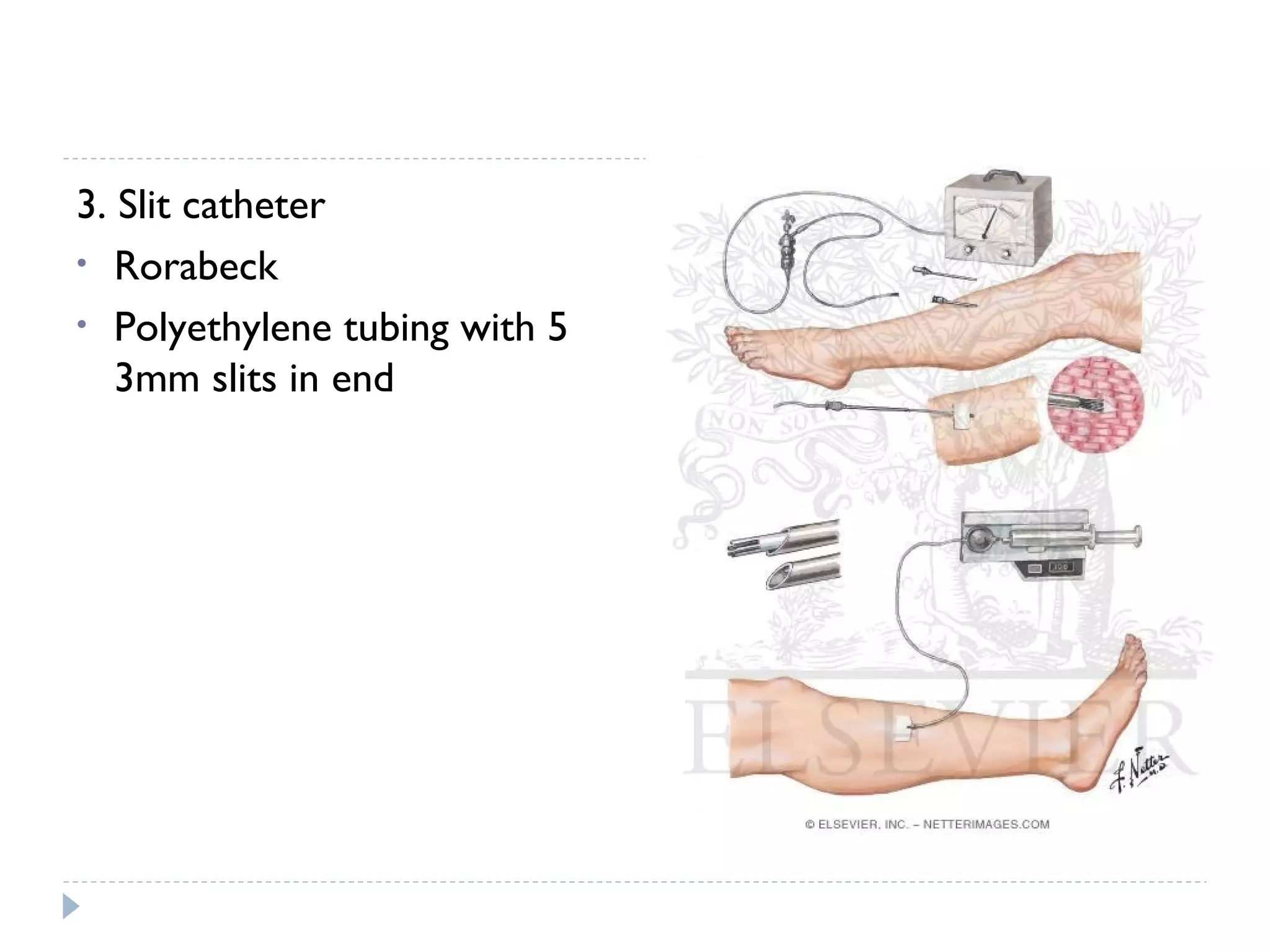 3. Slit catheter
• Rorabeck
• Polyethylene tubing with 5
3mm slits in end
 