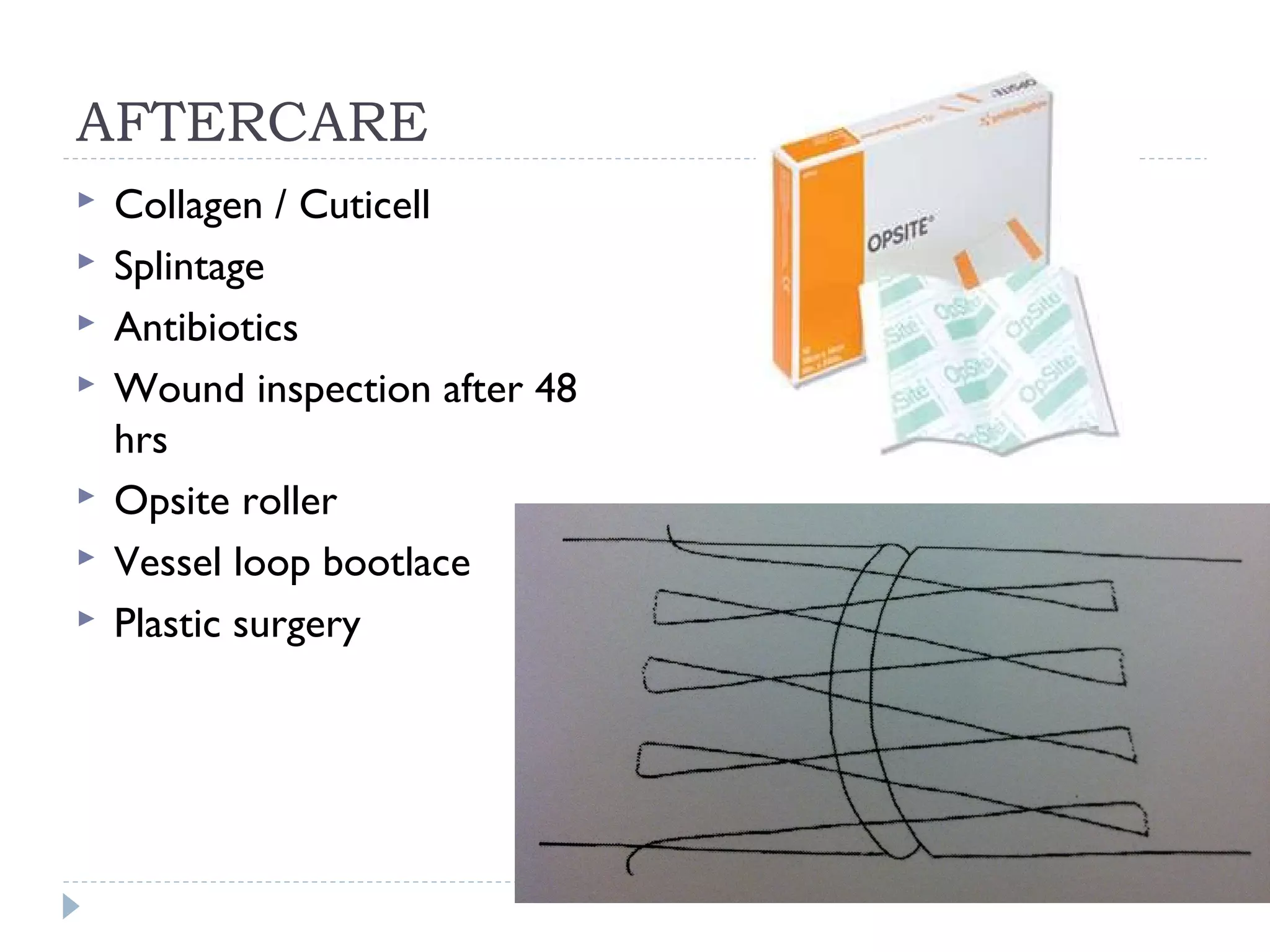AFTERCARE
 Collagen / Cuticell
 Splintage
 Antibiotics
 Wound inspection after 48
hrs
 Opsite roller
 Vessel loop bootlace
 Plastic surgery
 
