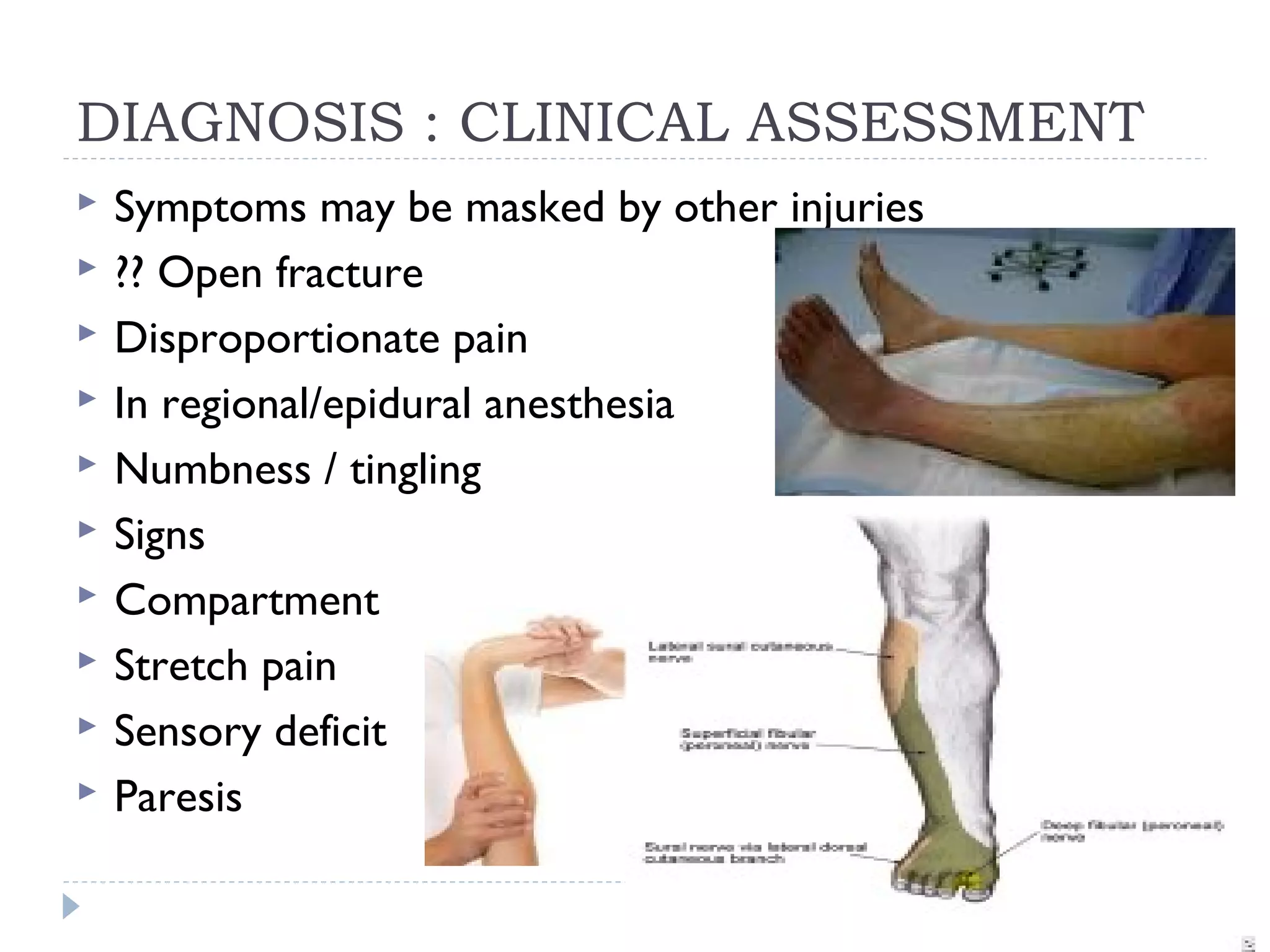 DIAGNOSIS : CLINICAL ASSESSMENT
 Symptoms may be masked by other injuries
 ?? Open fracture
 Disproportionate pain
 In regional/epidural anesthesia
 Numbness / tingling
 Signs
 Compartment
 Stretch pain
 Sensory deficit
 Paresis
 