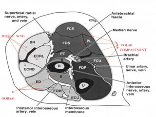 MOBILE WAD
VOLAR
COMPARTMENT
DORSAL
 