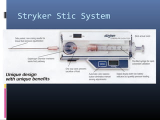 Stryker Stic System
 Easy to use
 Can check multiple compartments
 Different areas in one compartment
 