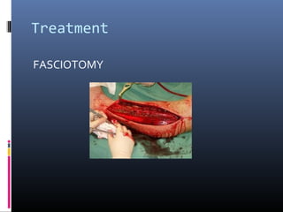 Treatment
FASCIOTOMY
 