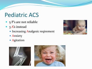 Pediatric ACS
 5 P’s are not reliable
 3 A’s instead
 Increasing Analgesic reqirement
 Anxiety
 Agitation
 