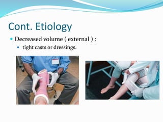Cont. Etiology
 Decreased volume ( external ) :
 tight casts or dressings.
 