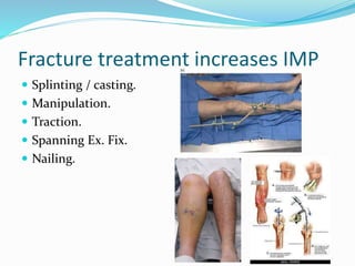 Fracture treatment increases IMP
 Splinting / casting.
 Manipulation.
 Traction.
 Spanning Ex. Fix.
 Nailing.
 