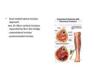 Acute compartment syndrome management.pptx