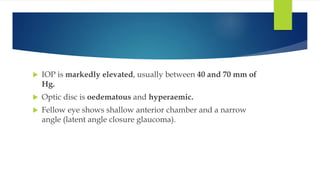  IOP is markedly elevated, usually between 40 and 70 mm of
Hg.
 Optic disc is oedematous and hyperaemic.
 Fellow eye shows shallow anterior chamber and a narrow
angle (latent angle closure glaucoma).
 