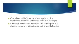  Central corneal indentation with a squint hook or
indentation goniolens to force aqueous into the angle.
 Epithelial oedema can be cleared first with topical 50%
glycerol to improve visualization and to avoid abrasion
 