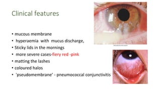 What R Coloured Halos ACUTE CONJUNCTIVITIS pptn.pptx