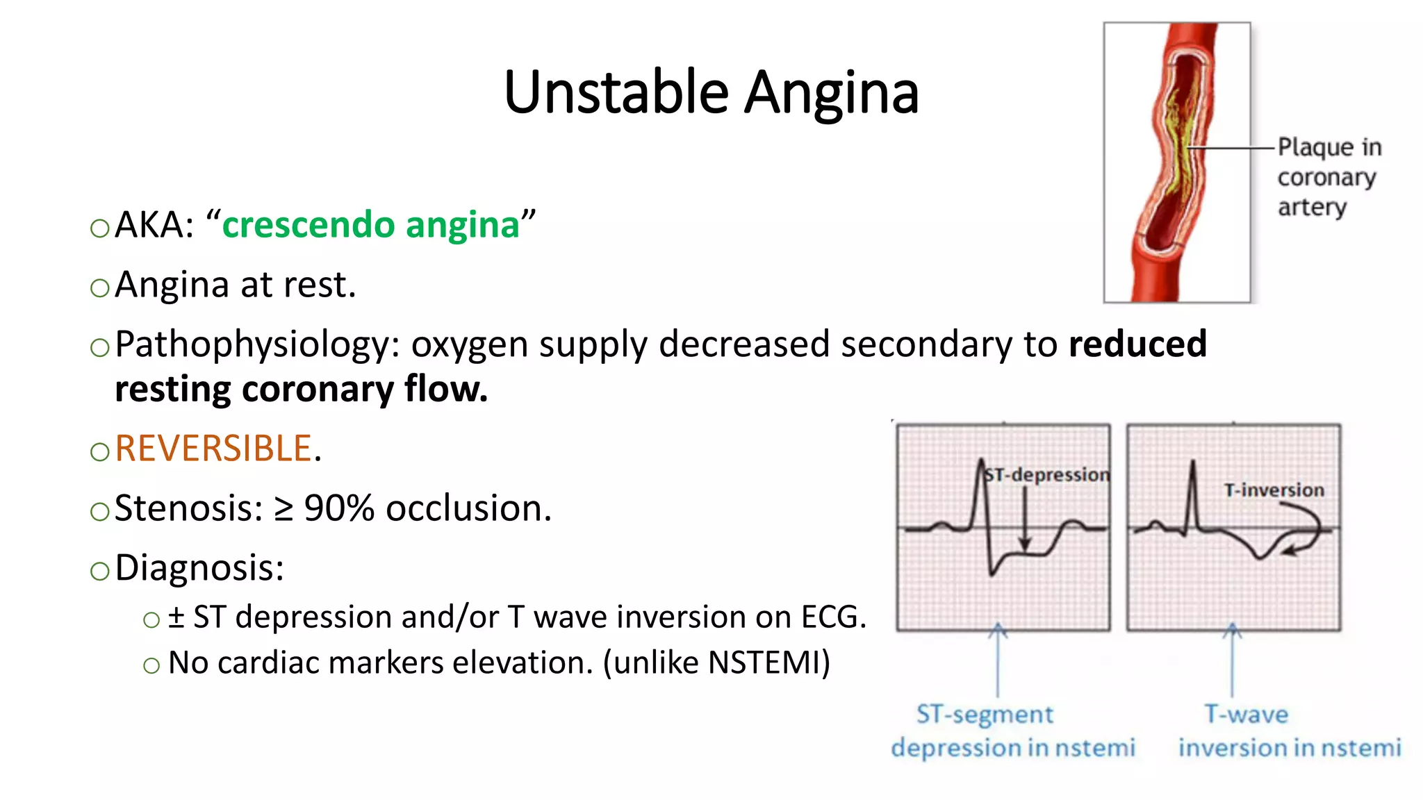 Acute Coronary Syndrome | PDF