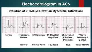Acute Coronary Syndrome based on ESC 2023 guidelines on the management ...