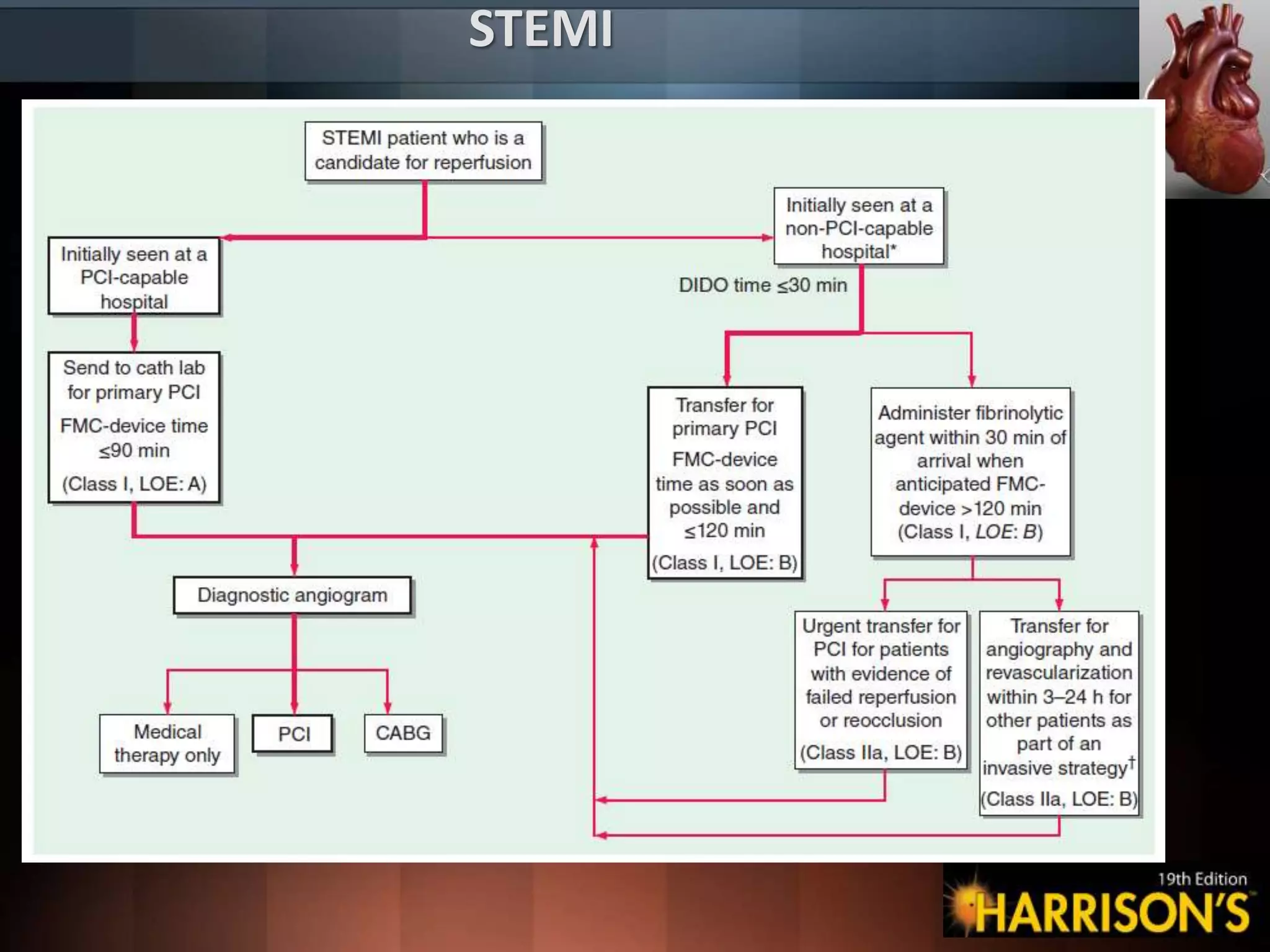 STEMI
 