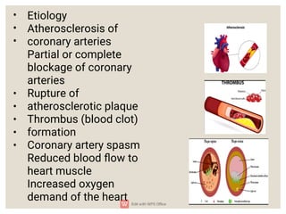 Acute Coronary Syndrome Myocardial Infarction and Angina.pdf