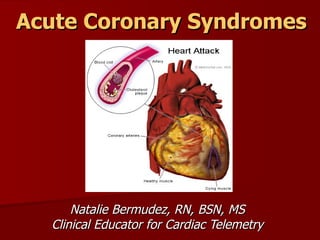 Acute Coronary Syndromes




      Natalie Bermudez, RN, BSN, MS
  Clinical Educator for Cardiac Telemetry
 