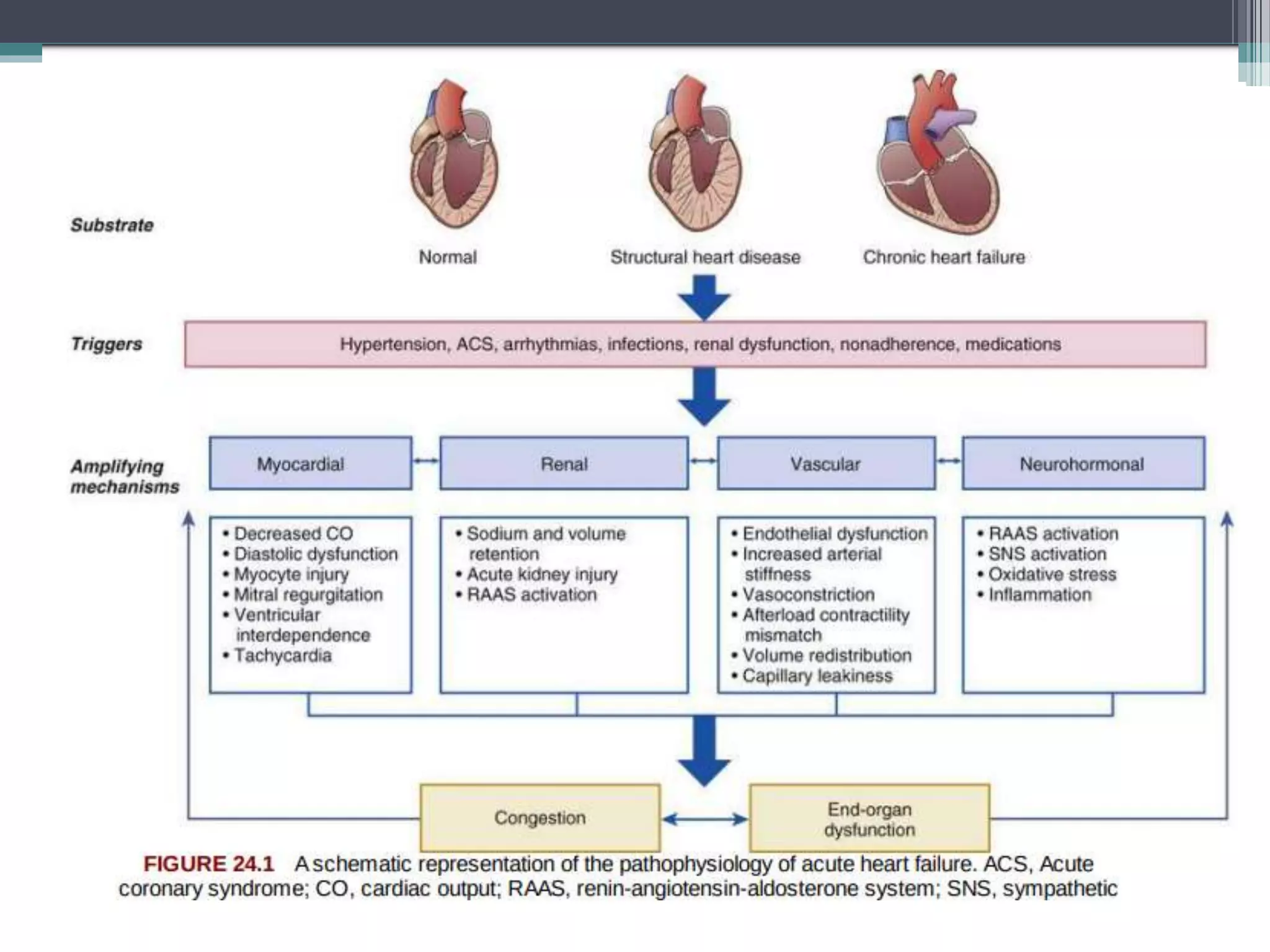 Acute decompensated heart failure | PPTX