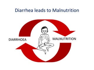 Diarrhea leads to Malnutrition
DIARRHOEA MALNUTRITION
 