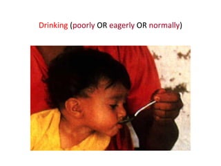 Drinking (poorly OR eagerly OR normally)
 