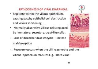 PATHOGENESIS OF VIRAL DIARRHEAS
• Replicate within the villous epithelium,
causing patchy epithelial cell destruction
and ...