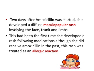 Acute disseminated encephalomyelitis (ADEM) .Case Report. | PPTX