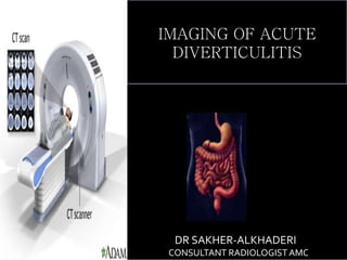 CT
DR SAKHER-ALKHADERI
CONSULTANT RADIOLOGISTAMC
IMAGING OF ACUTE
DIVERTICULITIS
 