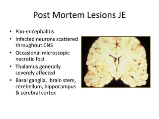 Post Mortem Lesions JE
• Pan-encephalitis
• Infected neurons scattered
throughout CNS
• Occasional microscopic
necrotic foci
• Thalamus generally
severely affected
• Basal ganglia, brain stem,
cerebellum, hippocampus
& cerebral cortex
 