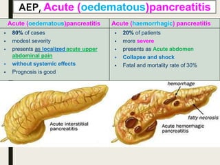 AEP, Acute (oedematous)pancreatitis
Acute (oedematous)pancreatitis Acute (haemorrhagic) pancreatitis
 80% of cases
 modest severity
 presents as localizedacute upper
abdominal pain
 without systemic effects
 Prognosis is good
 20% of patients
 more severe
 presents as Acute abdomen
 Collapse and shock
 Fatal and mortality rate of 30%
 