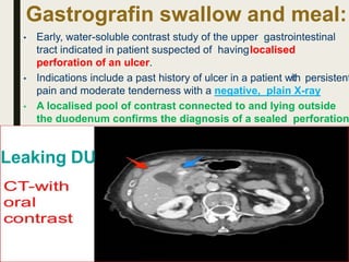 Gastrografin swallow and meal:
• Early, water-soluble contrast study of the upper gastrointestinal
tract indicated in patient suspected of havinglocalised
perforation of an ulcer.
• Indications include a past history of ulcer in a patient with persistent
pain and moderate tenderness with a negative, plain X-ray
• A localised pool of contrast connected to and lying outside
the duodenum confirms the diagnosis of a sealed perforation
Leaking DU
 