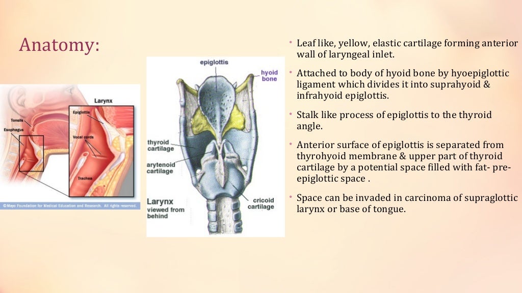 Acute epiglottitis