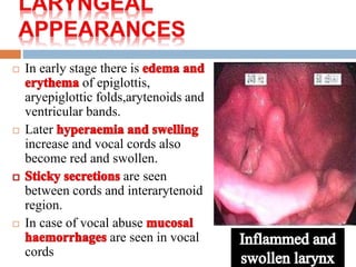  In early stage there is 
of epiglottis, 
aryepiglottic folds,arytenoids and 
ventricular bands. 
 Later 
increase and vocal cords also 
become red and swollen. 
are seen 
between cords and interarytenoid 
region. 
 In case of vocal abuse 
are seen in vocal 
cords 
 