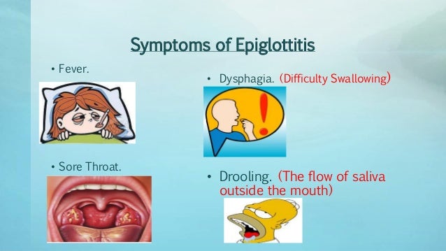 Acute epiglottitis by Joselyn