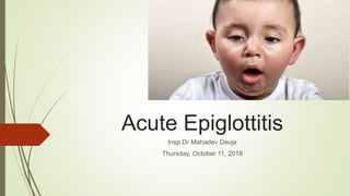 Acute Epiglottitis
Insp Dr Mahadev Deuja
Thursday, October 11, 2018
 