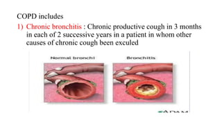 ACUTE EXACERBATION OF CHRONIC OBSTRUCTIVE PULMONARY DISEASE | PPTX