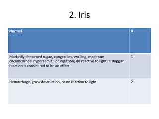 2. Iris
Normal 0
Markedly deepened rugae, congestion, swelling, moderate
circumcorneal hyperaemia; or injection; iris reactive to light (a sluggish
reaction is considered to be an effect
1
Hemorrhage, gross destruction, or no reaction to light 2
 
