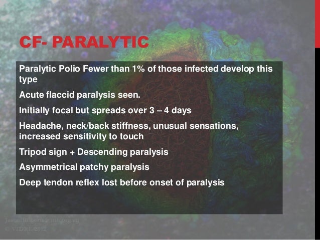 Acute Flaccid Paralysis – acute flaccid paralysis – YUHEP