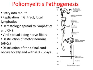 Poliomyelitis Pathogenesis
Entry into mouth
Replication in GI tract, local
lymphatics
Hematologic spread to lymphatics
and CNS
Viral spread along nerve fibers
Destruction of motor neurons
(AHCs)
Destruction of the spinal cord
occurs focally and within 3 - 6days .
 