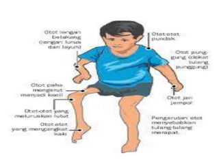 acute flacid paralysis approach-2.pptx