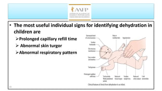 • The most useful individual signs for identifying dehydration in
children are
Prolonged capillary refill time
 Abnormal skin turgor
Abnormal respiratory pattern
22
 