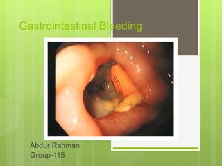 Gastrointestinal Bleeding
Abdur Rahman
Group-115
 