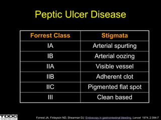 Peptic Ulcer Disease
Forrest Class Stigmata
IA Arterial spurting
IB Arterial oozing
IIA Visible vessel
IIB Adherent clot
IIC Pigmented flat spot
III Clean based
Forrest JA, Finlayson ND, Shearman DJ: Endoscopy in gastrointestinal bleeding. Lancet 1974; 2:394-7
 