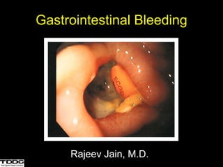 Gastrointestinal Bleeding
Rajeev Jain, M.D.
 