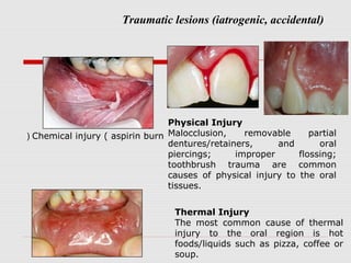 Traumatic lesions (iatrogenic, accidental)
Chemical injury ( aspirin burn(
Physical Injury
Malocclusion, removable partial
dentures/retainers, and oral
piercings; improper flossing;
toothbrush trauma are common
causes of physical injury to the oral
tissues.
Thermal Injury
The most common cause of thermal
injury to the oral region is hot
foods/liquids such as pizza, coffee or
soup.
 