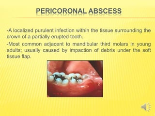 Eruption Abscess Acute gingival conditions.pptx