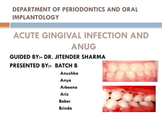ACUTE_GINGIVAL_INFECTION 0019847363647466363 | PPTX