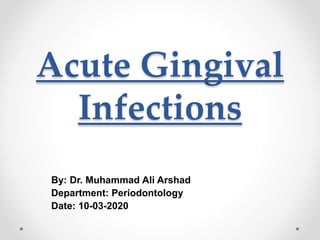 Acute Gingival
Infections
By: Dr. Muhammad Ali Arshad
Department: Periodontology
Date: 10-03-2020
 