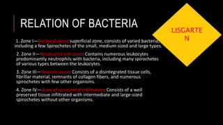Acute gingival infections and desquamative gingivitis | PPTX