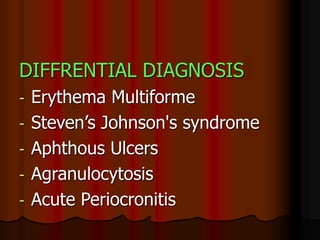 DIFFRENTIAL DIAGNOSIS
- Erythema Multiforme
- Steven’s Johnson's syndrome
- Aphthous Ulcers
- Agranulocytosis
- Acute Periocronitis
 