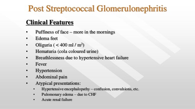 Acute Glomerulonephritis For Ugs