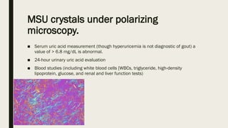 MSU crystals under polarizing
microscopy.
■ Serum uric acid measurement (though hyperuricemia is not diagnostic of gout) a
value of > 6.8 mg/dL is abnormal.
■ 24-hour urinary uric acid evaluation
■ Blood studies (including white blood cells [WBCs, triglyceride, high-density
lipoprotein, glucose, and renal and liver function tests)
■
 
