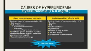 CAUSES OF HYPERURICEMIA
 