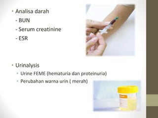 • Analisa darah
- BUN
- Serum creatinine
- ESR

• Urinalysis
• Urine FEME (hematuria dan proteinuria)
• Perubahan warna urin ( merah)

 